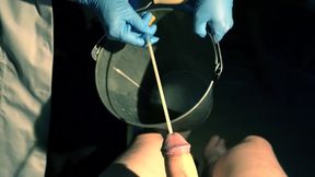 POV Patient. Sounding and Placing a Catheter