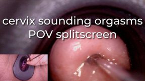 cervix sounding orgasms POV splitscreen