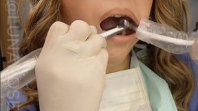 10 min POV Watch Dental Assistant Luna perform a dental filling procedure on herself with her real dental unit and instruments