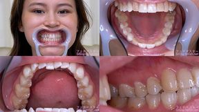 Erika Kononoba - Watching Inside mouth of Japanese cute girl
