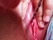 First urethral sounding