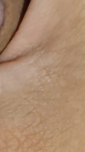 Amazing Dilator Vessel Has Disproportionate Increase.