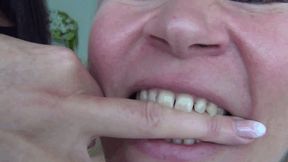 Victoria bites my hand and my fingers hard B