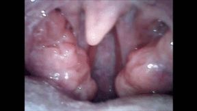 After blowjob, endoscopy wmv