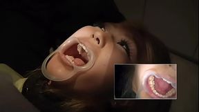 Dentist does work on Asian girl
