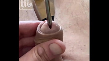 Metal dilator in my peehole 5