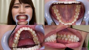 Natuki Takeuchi - Watching Inside mouth of Japanese cute girl - 1080p