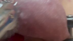 Shark teeth on besties balls