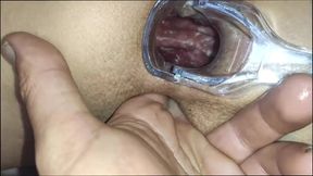 Ass and Pussy Fingering