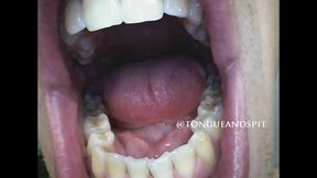 Logan Endoscope Teeth Part21 Video1 - MP4