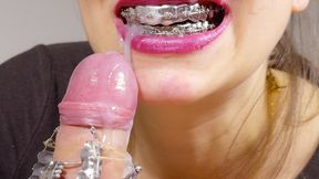 BRACES dentist roleplay, DIRTY TALK, HUGE cumshot