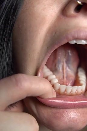 Mouth Tour with Dentures in