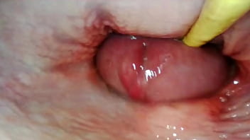 AMAZING INTERNAL POV. CAMERA INSIDE HER PUSSY WHILE I FILL HER WITH CUM