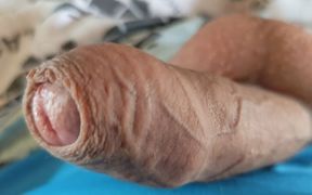 Boy Masturbates Phimosis and Close up of Pre Cum.