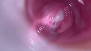 Camera deep inside teen creamy pussy