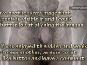 More than skin deep - an x-ray view of my dick!!