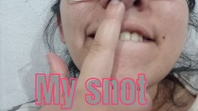 My snot today