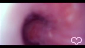 Fucked in My Pussy, Camera in My Bladder, Crazy Bulge!