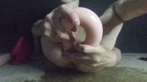 Anal prolapse
