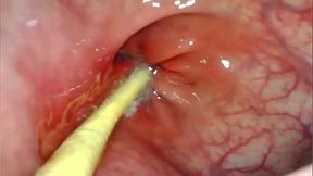 POV: Big Cock Pounding Anal Slut's Gaping Ass