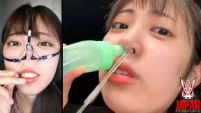 Sara Kagami with her nose opened | Nose hook, suction device and swabs