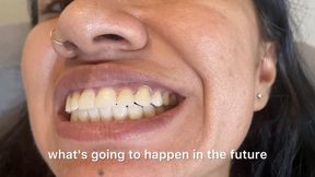 Yellow teeth