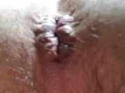 Suck My Fart