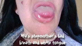 Mia's stepmother's bad breath and white tongue
