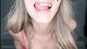 Braces sending game