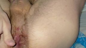 the prolapse squelches and exposes the rose