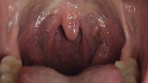 SASHAS UVULA
