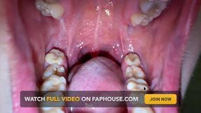 Mouth Secrets: Thick White Coating on My Tongue