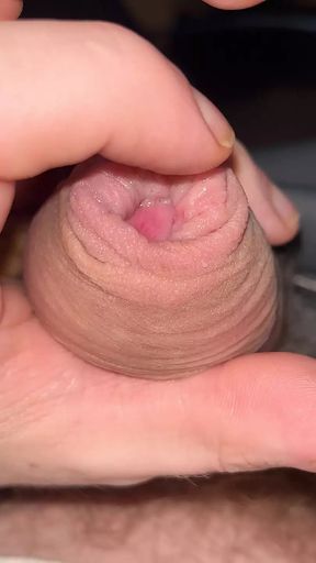 Wet foreskin close up.