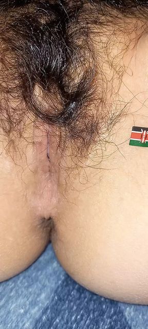 Nairobi anus