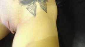 My Stretch Marks
