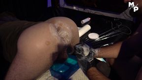 Fisted bubble butt drilled with a giant dildo