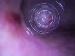 Fiberscope in urethral test tube