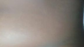 My belly button after labour
