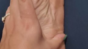 Dry soles need attention