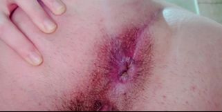 My Hairy Asshole Wants You to Lick It and Enjoys Getting Really Close to Your Face