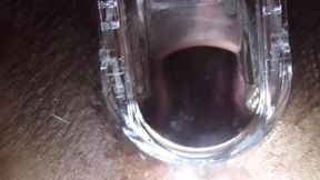 Cum Cervix Insemination