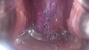 Cum Cervix Insemination