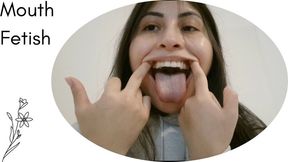 opening my huge mouth for you crooked teeth
