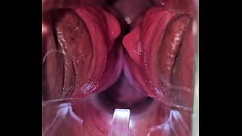 Speculum cervix play cumming