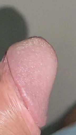 Boy with Large Anal Phimosis Excited!