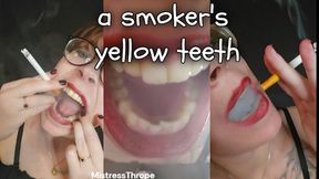 A Smokers Yellow Teeth