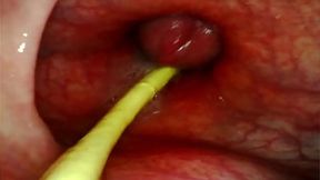 EXTREME ANAL POV CAMERA INSIDE HER ASSHOLE AS I POUND HER WITH MY BIG COCK AND CUM DEEP INSIDE