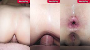 colombiana sabrinafoxy. fui al medico por culpa de mi ansiedad anal, y me aplico un tratamiento fuerte para curarme. me rompe el culo y deja su leche adentro