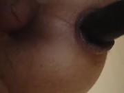 Anus dilatation