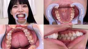 Shizuku - Watching Inside mouth of Japanese cute girl bite-176-1 - wmv 1080p